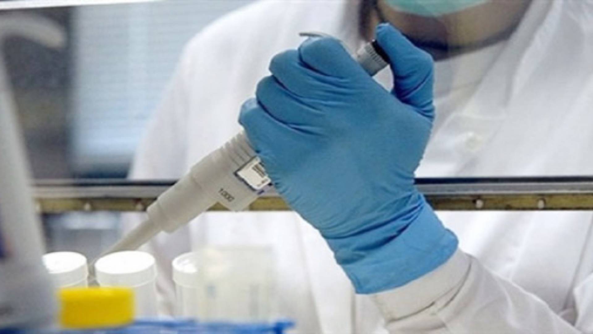 الصورة تعبيرية