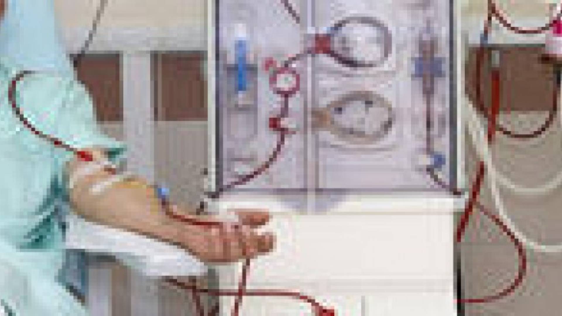 دراسة أمريكية : 40 ألف مريض كلى يلقى حتفه عطشا سنويا