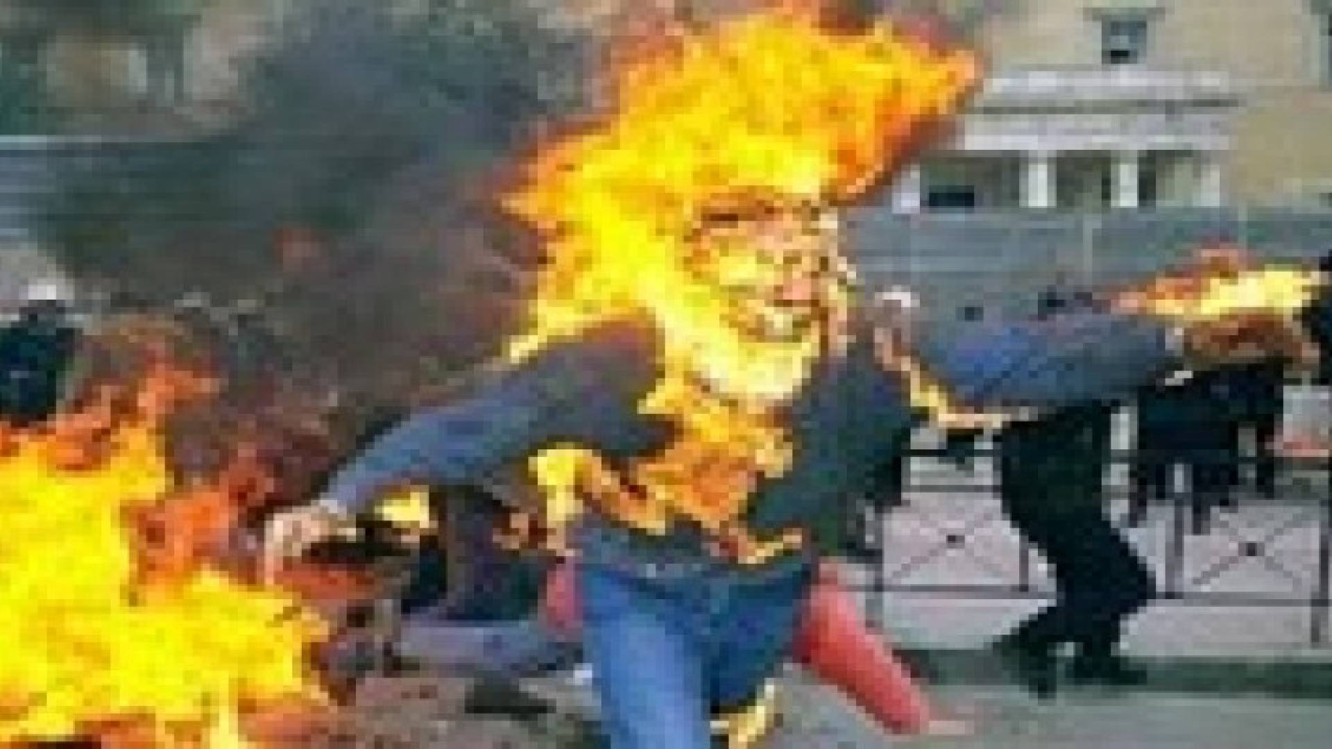 شاب يحرق نفسه بعد رفض ذويه تزويجه