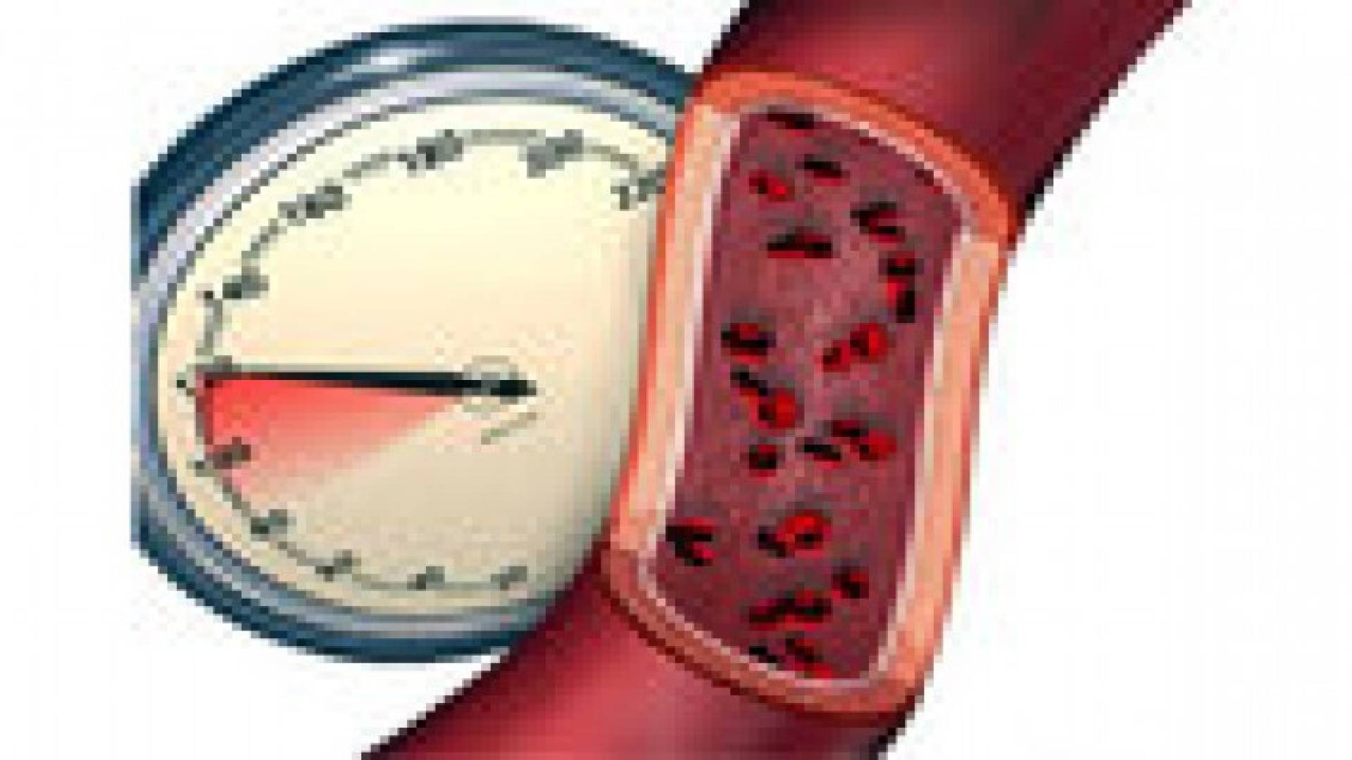 جهاز يراقب ضغط الشريان الرئوى بالـ"وايرلس"