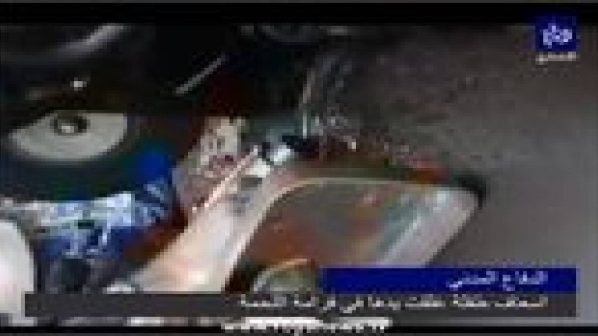 طفلة تفقد 4 اصابع من يدها في ماكنة " فرم اللحمة " .. فيديو