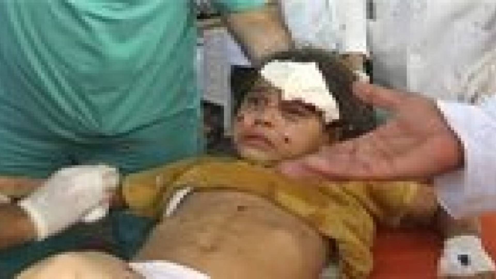 1810 شهداء وأكثر من 9400 جريح منذ بدء العدوان على غزة