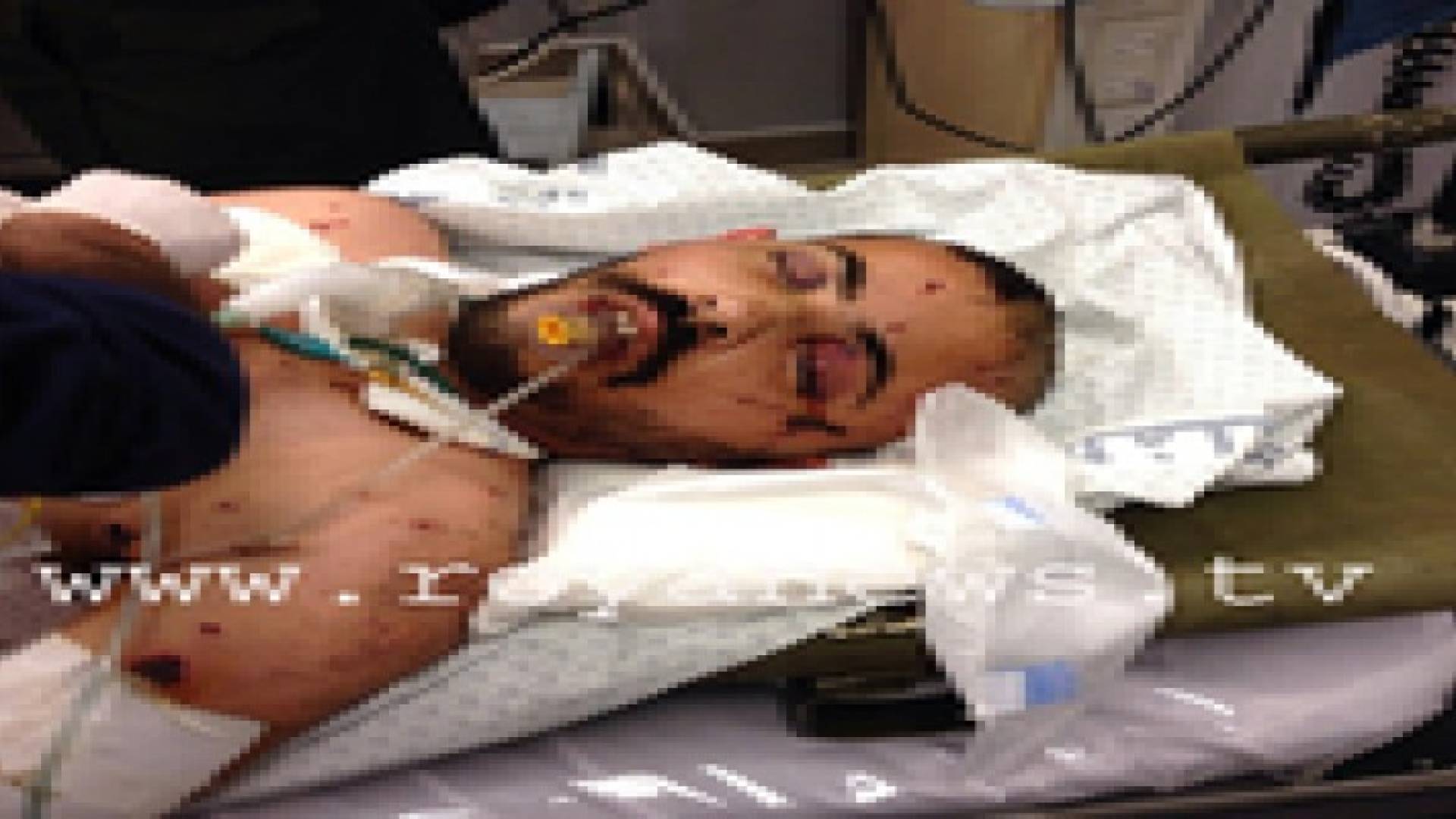 وفد من الأعيان يزور جرحى غزة في المدينة الطبية