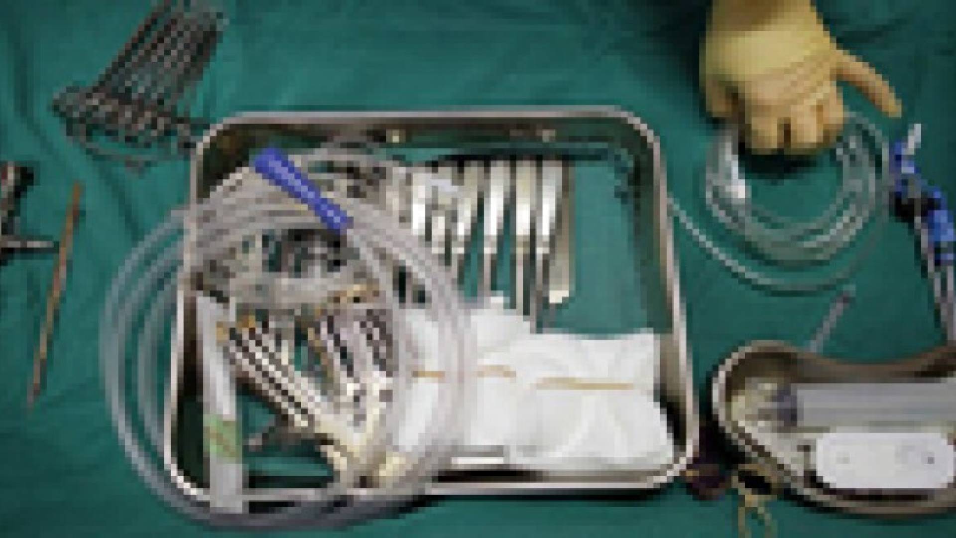 مصري يسرق ويبيع "كلية "زوجته بـ20 ألف جنيه عن طريق "حيلة الحمل"