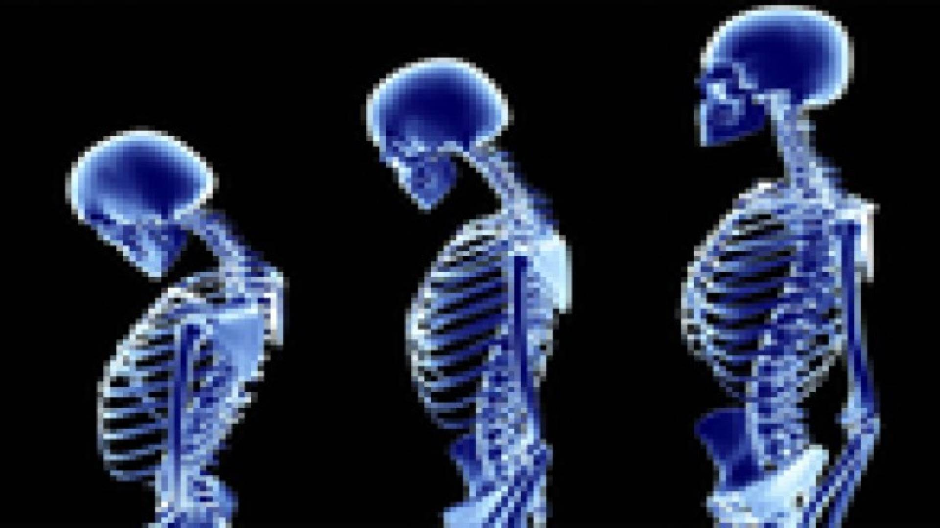 دراسة: الإنسان قادر على تعويض العظام المفقودة