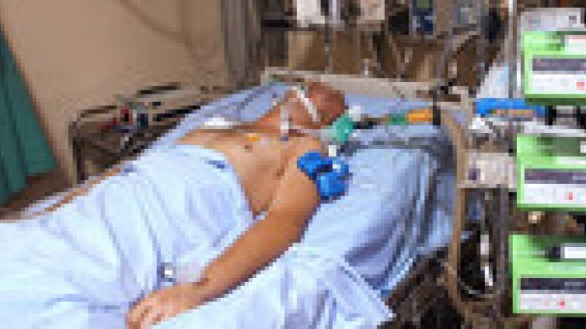 اكتشاف شكل من حالات الوعي لدى المرضى المصابين بالغيبوبة التامة