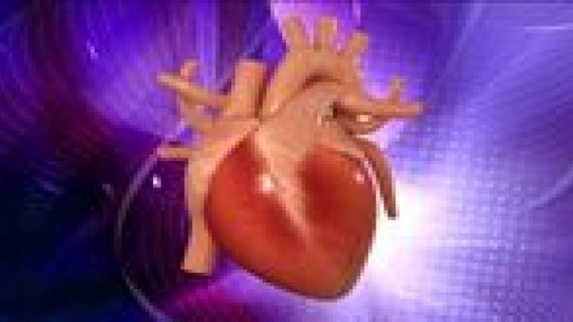 زراعة قلب متبرع بعد توقف النبض لأول مرة في تاريخ الطب