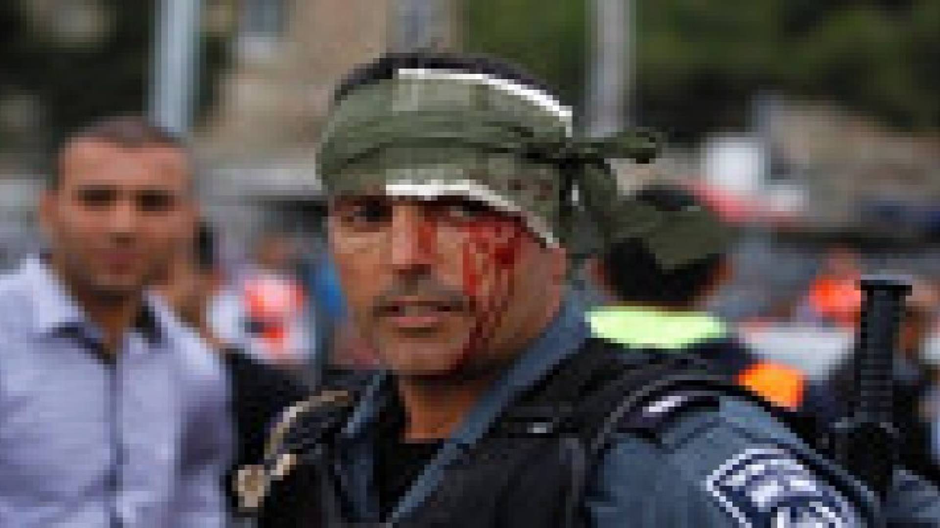 إصابة شرطي إسرائيلي بعد رشقه بالحجارة في القدس