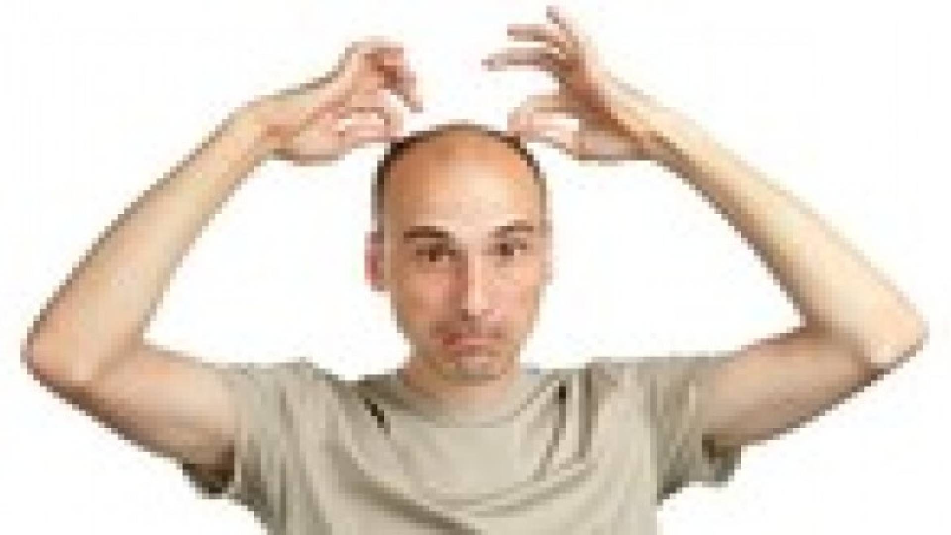 الحل الأمثل للتخلص من الصلع