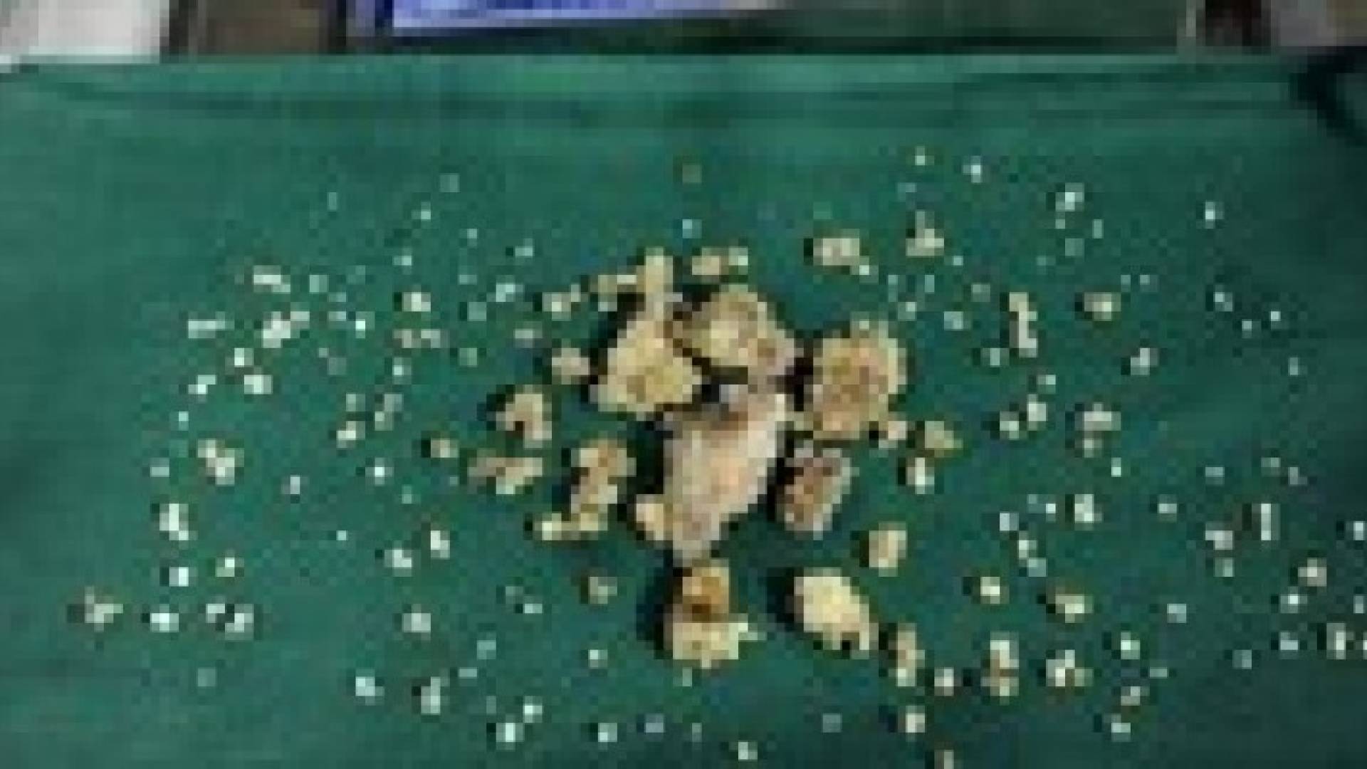 أطباء يقتلعون نحو 200 سن من فم طفلة هندية