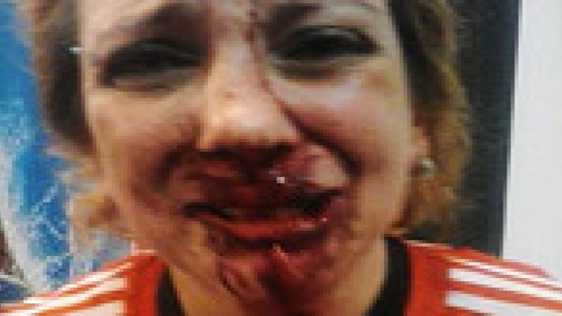 بالصور.. تحطيم وجه امرأة لأنها تشجع ريفربليت