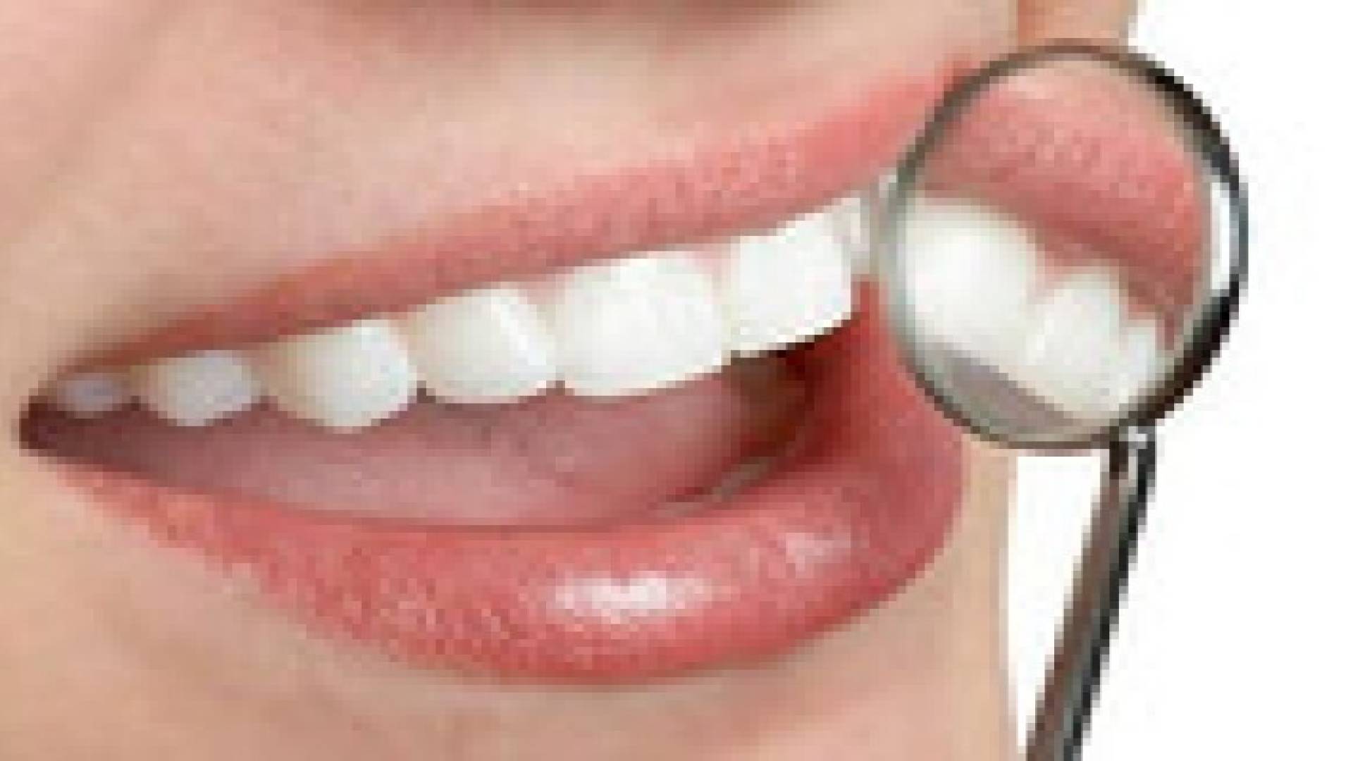 كيف تحصل على ابتسامة ناصعة البياض