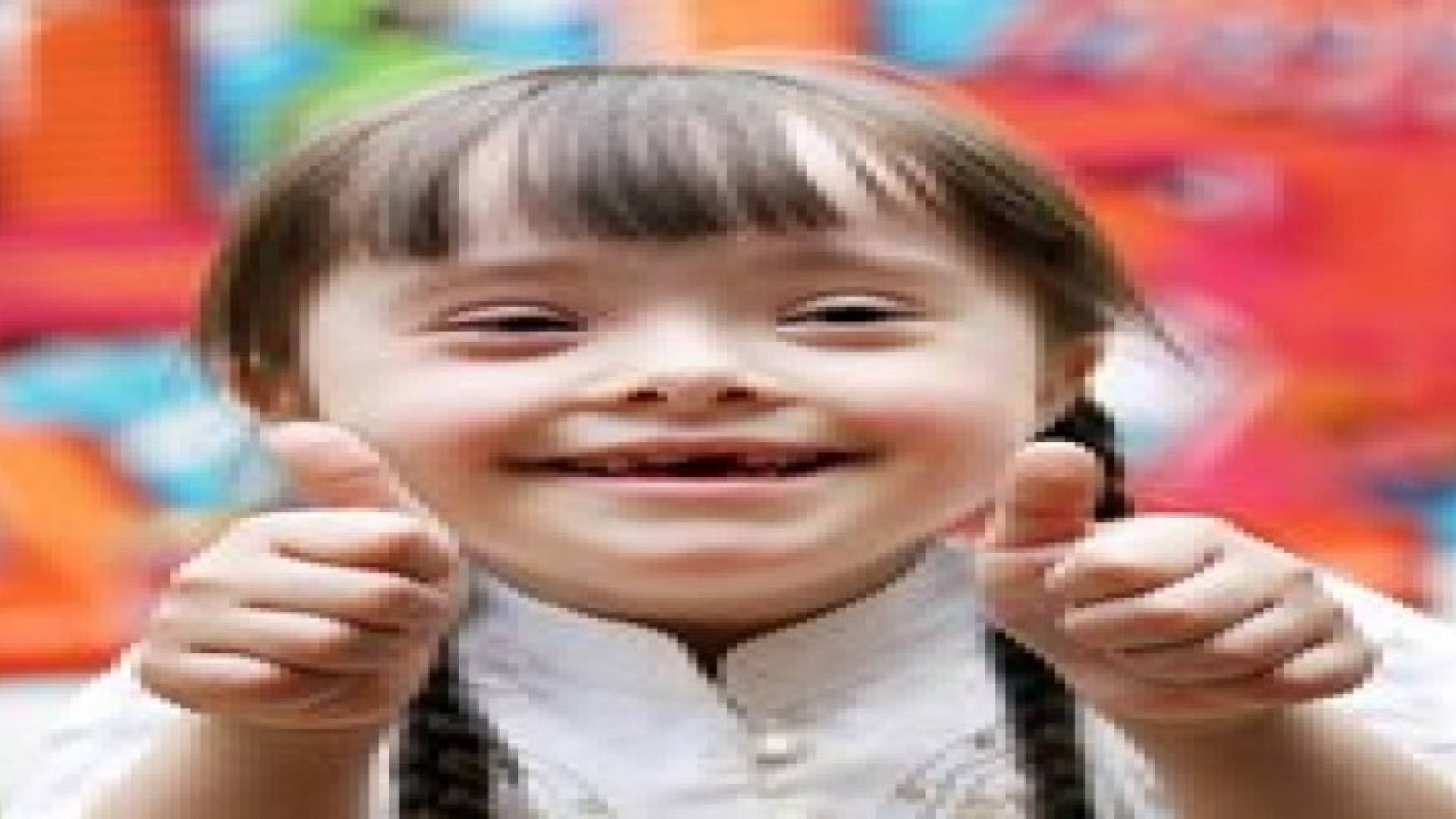 متلازمة داون بين القبول والرفض المجتمعي
