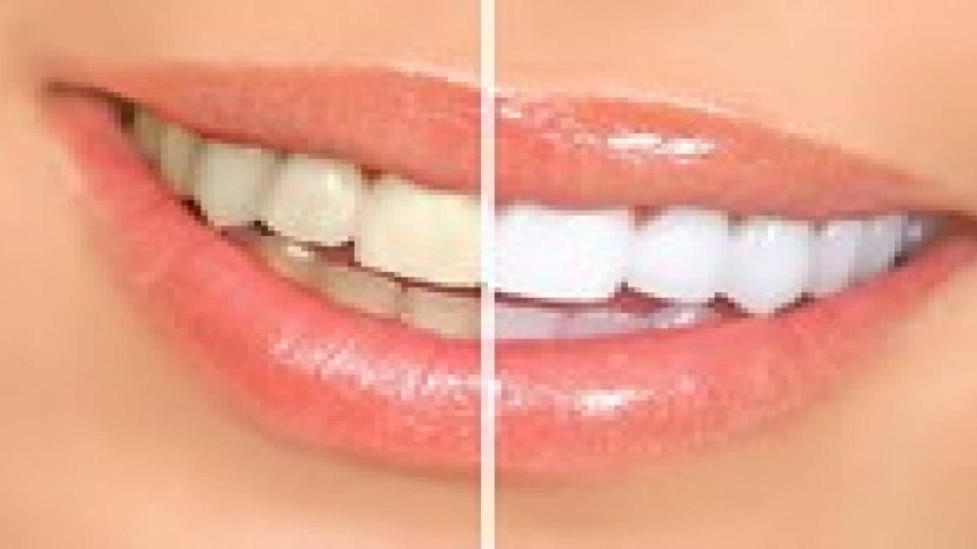 كيف تحصل على ابتسامة بيضاء ؟
