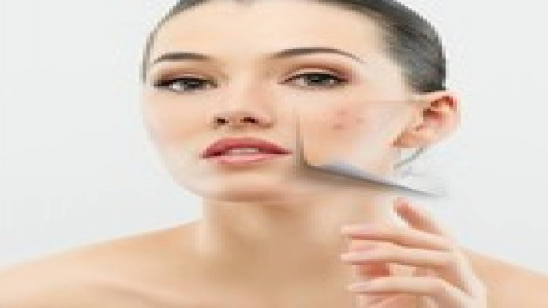 نصائح للتعامل مع حب الشباب