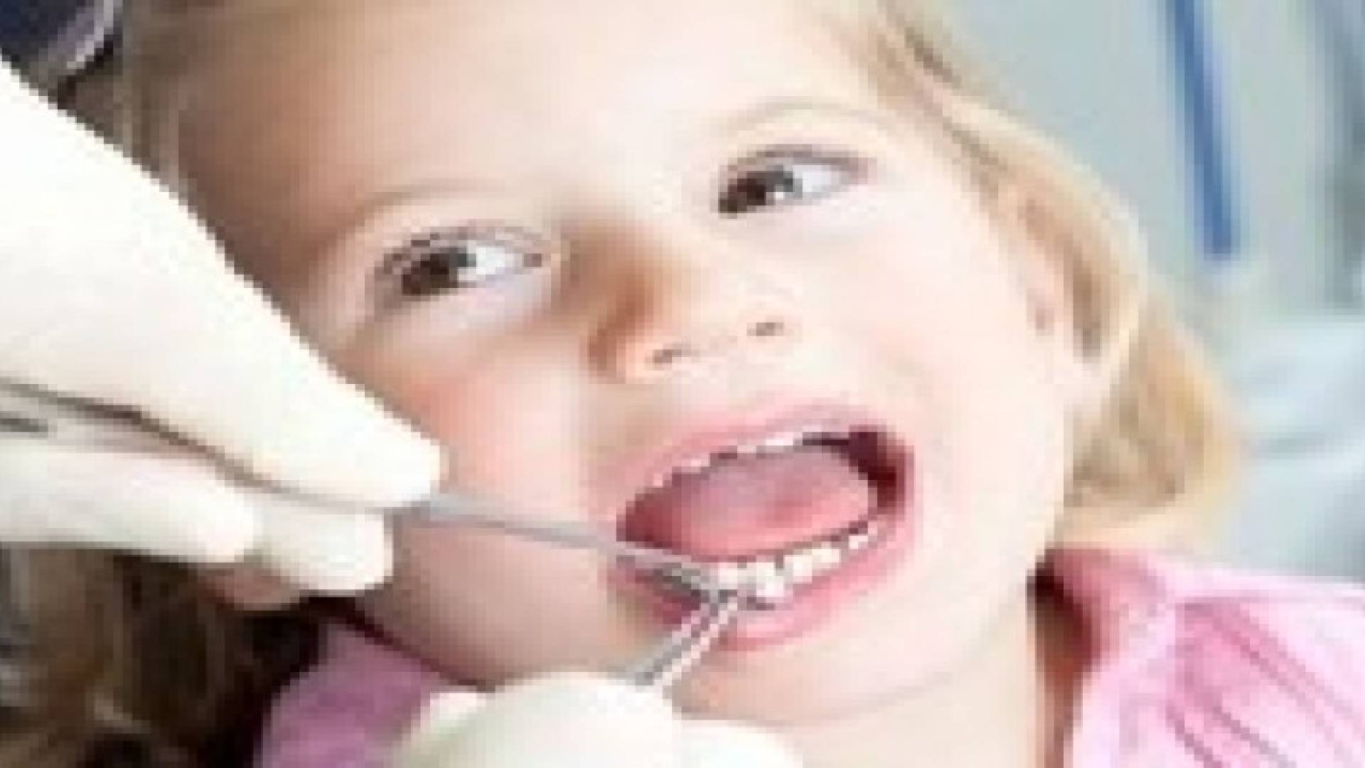 مشاكل الاسنان عند الاطفال