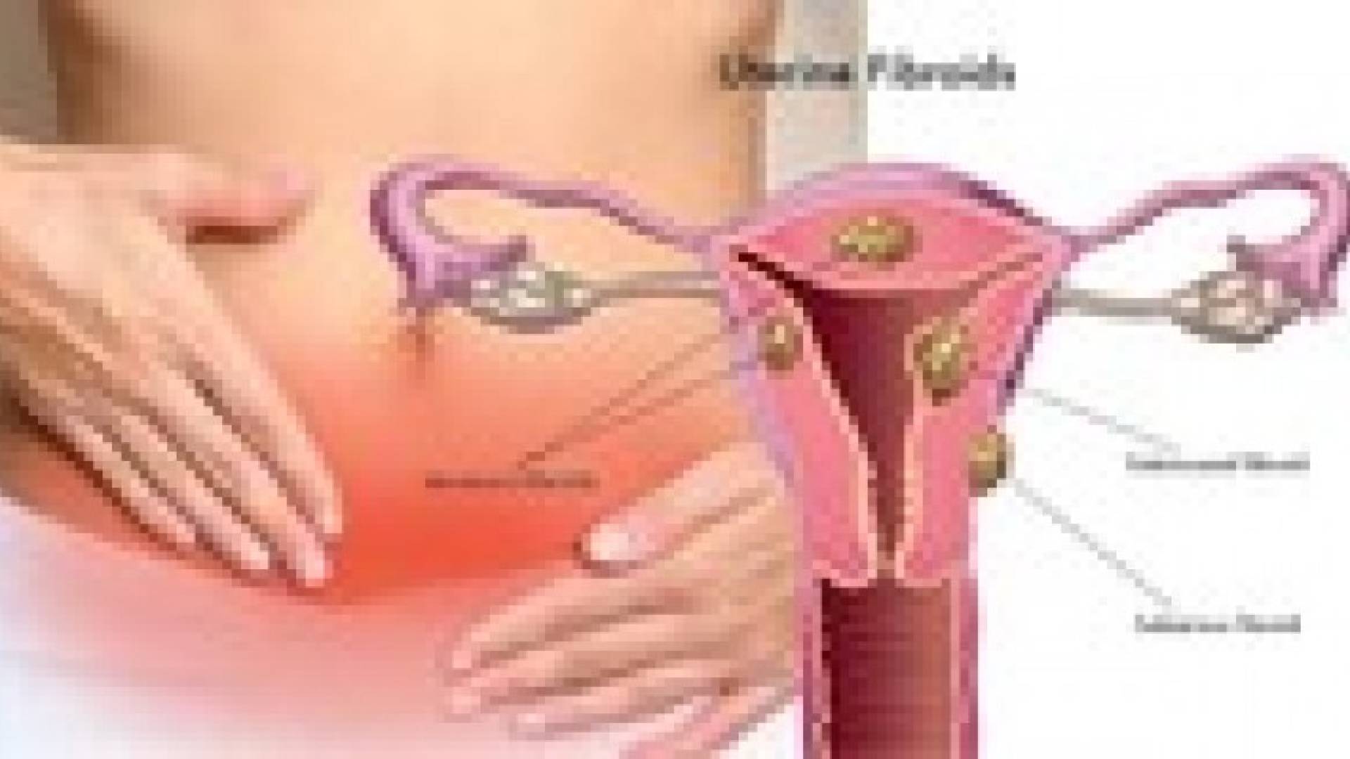 الالياف الرحمية