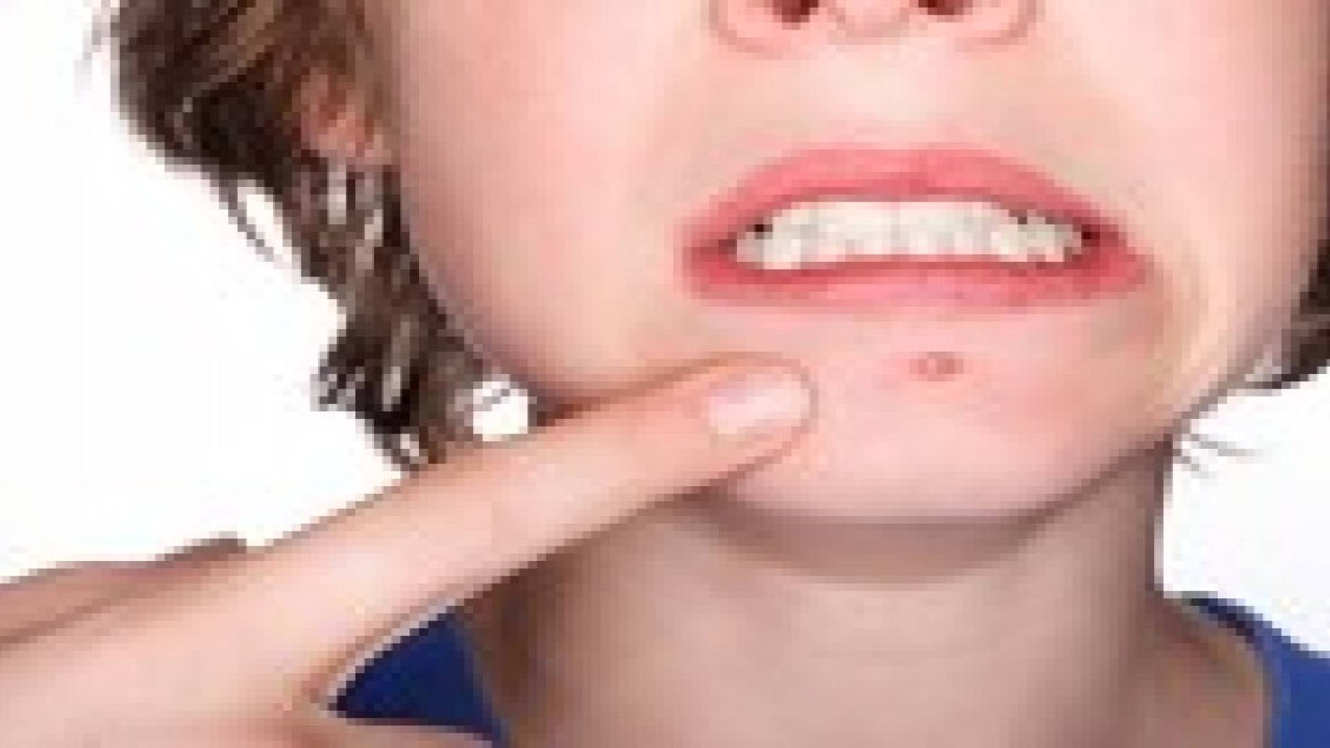 حب الشباب يوسع شريحة مستهدفيه ليطال جيل العقد الرابع