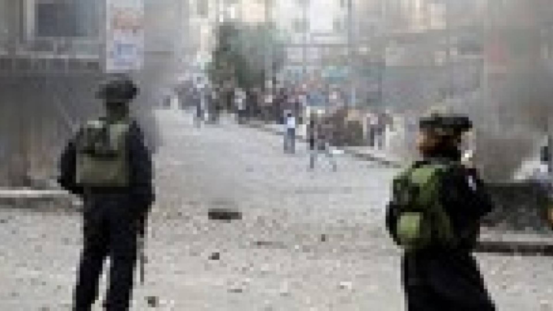 إصابة 5 فلسطينيين بجراح في مواجهات مع الاحتلال بالقدس المحتلة