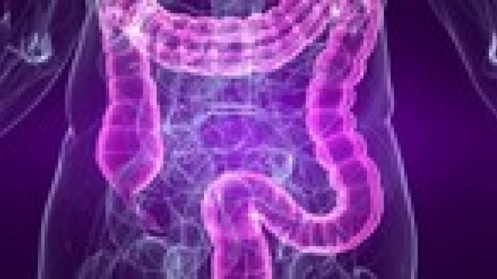 القولون العصبي (متلازمة القولون المتهيج )