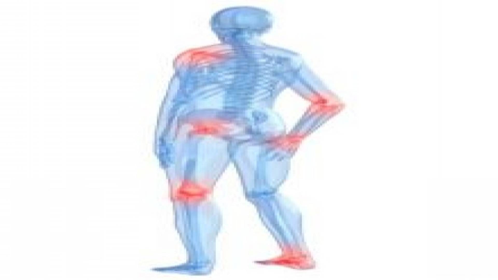 تجربة عقار محظور لعلاج التهاب المفاصل