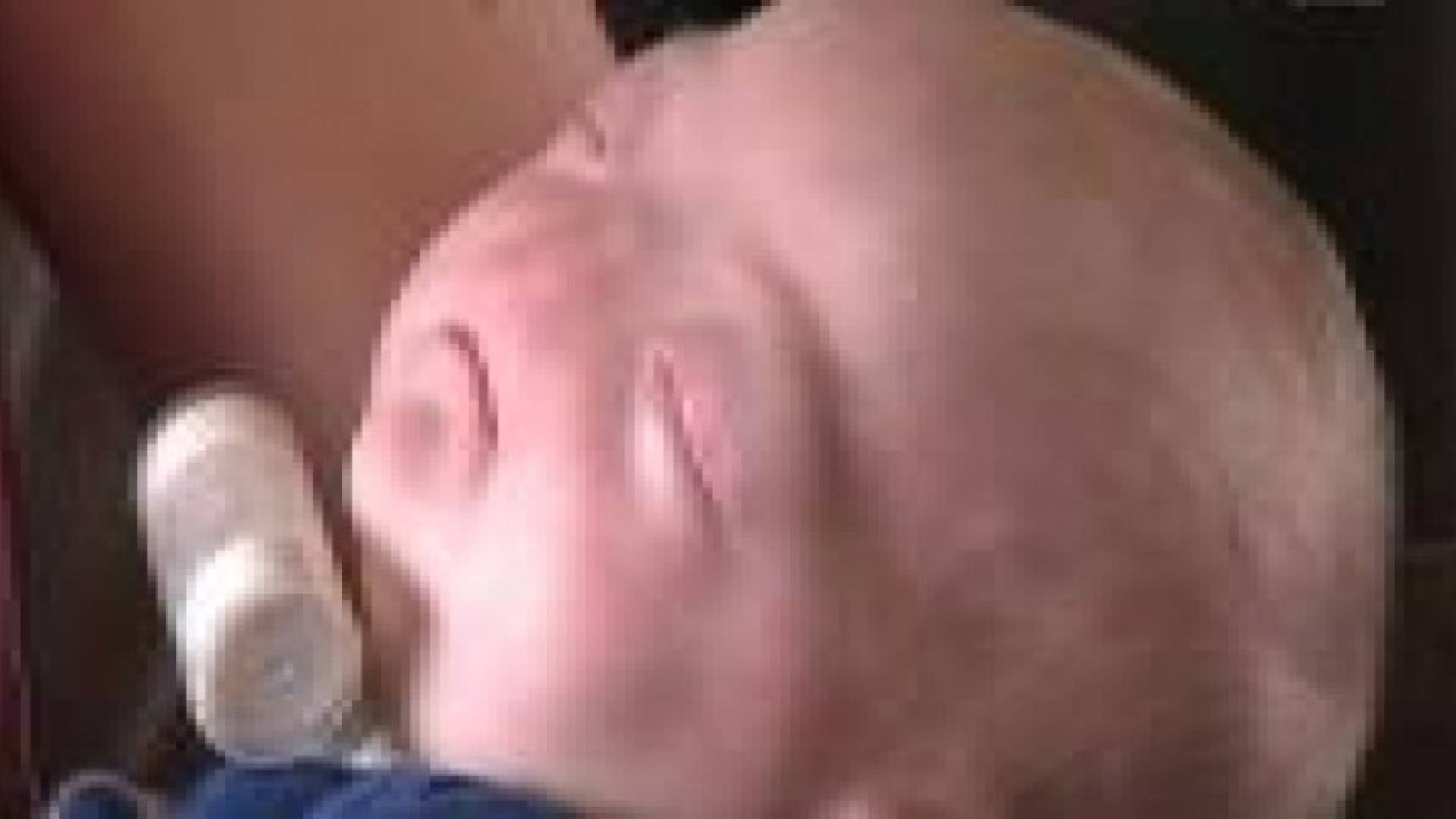 من أندر الحالات في العالم.. ولادة طفل من دون أنف .. فيديو