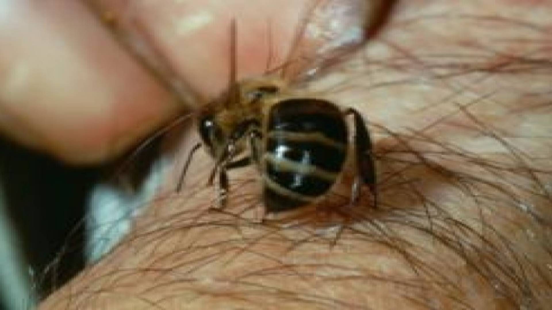 كيف تتعامل مع لدغات النحل والدبابير؟