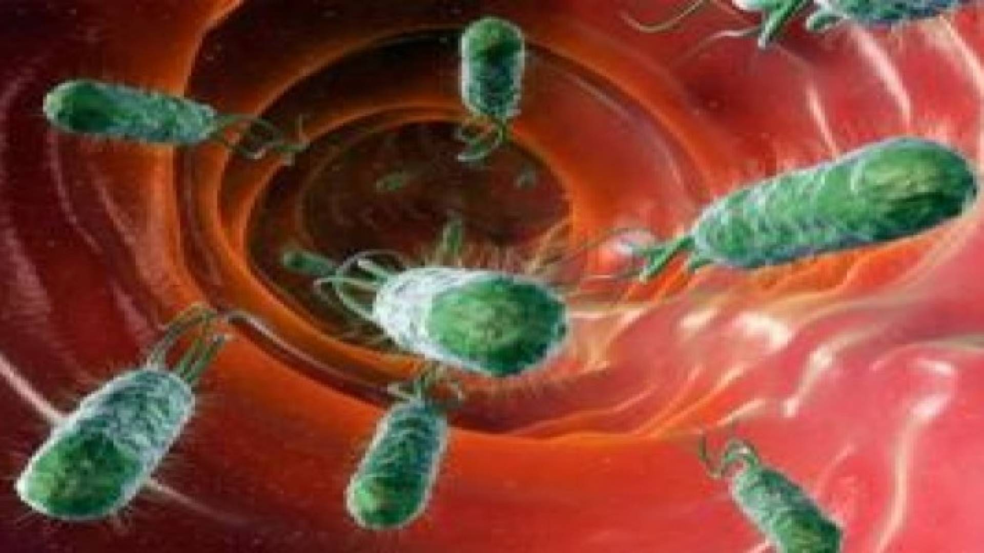 الرأي: جرثومة الـ (الايكولاي) سبب حالات تسمم في مادبا