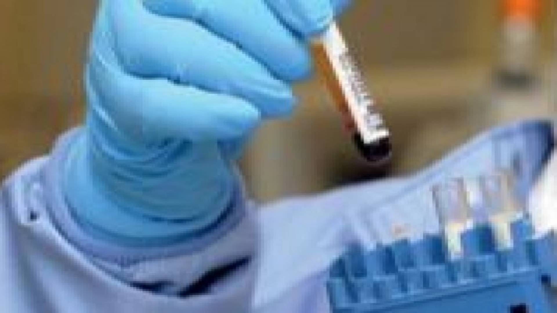 اختبار يتنبأ بالسرطان قبل 13 عاما