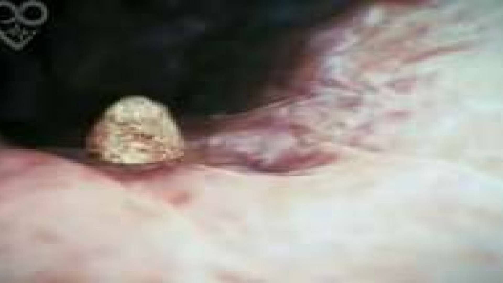 فيديو يظهر مراحل نمو الجنين داخل رحم امه لحظة بلحظة