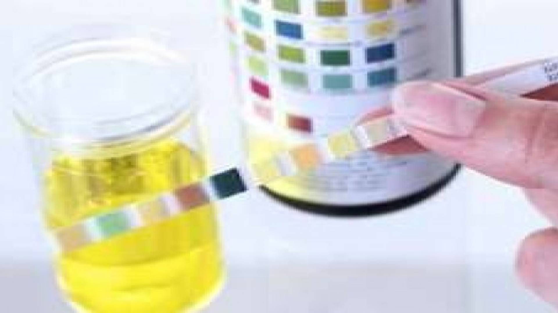 التهابات المسالك البولية.. هل تستدعي القلق؟