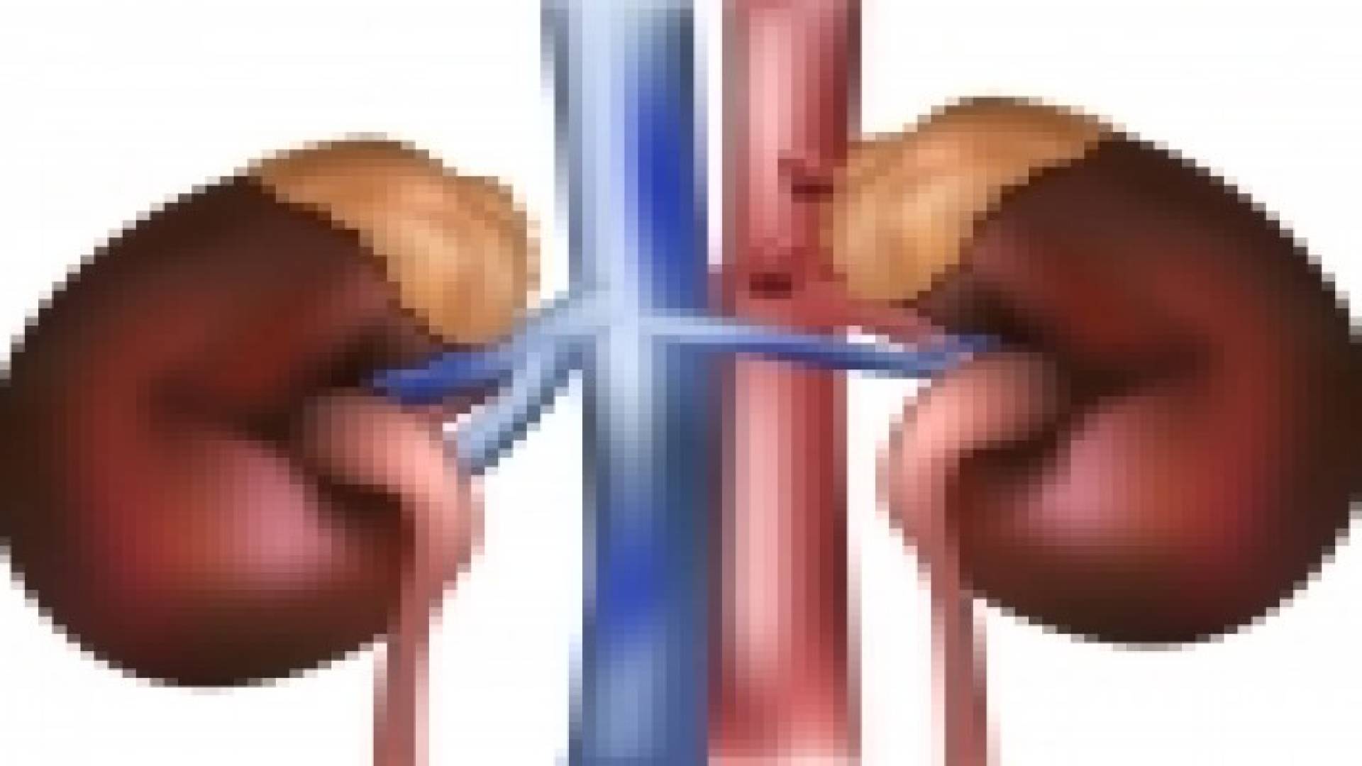 هل تكون الأعضاء الصناعية بديلا عن التبرع بالأعضاء؟