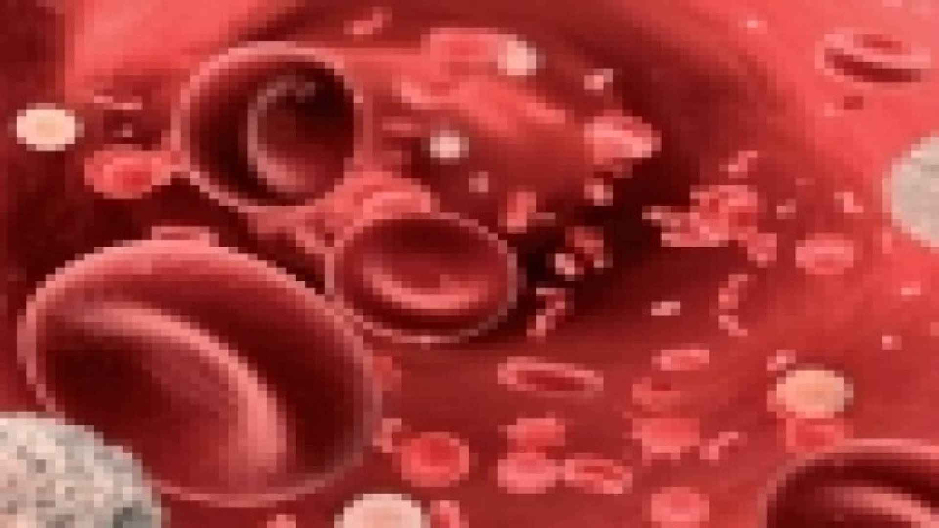 فقر الدم .. الأسباب والعلاج