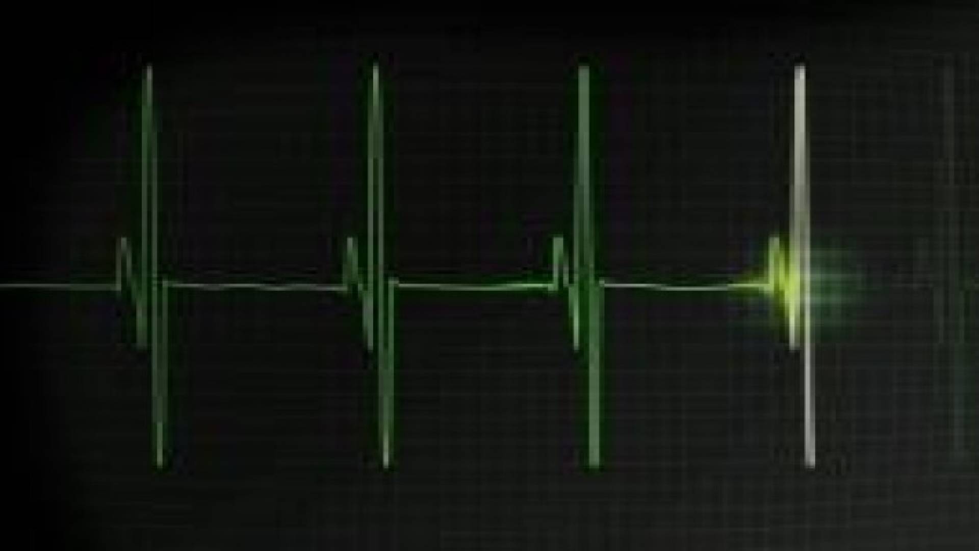 السمنة تزيد مخاطر عدم انتظام ضربات القلب