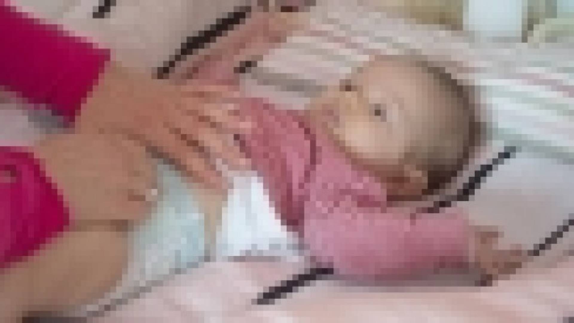 نصائح للوقاية من التهاب الجلد للأطفال