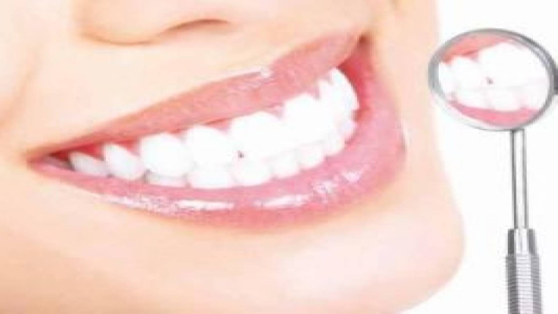 كيفية الوقاية من تسوس الأسنان