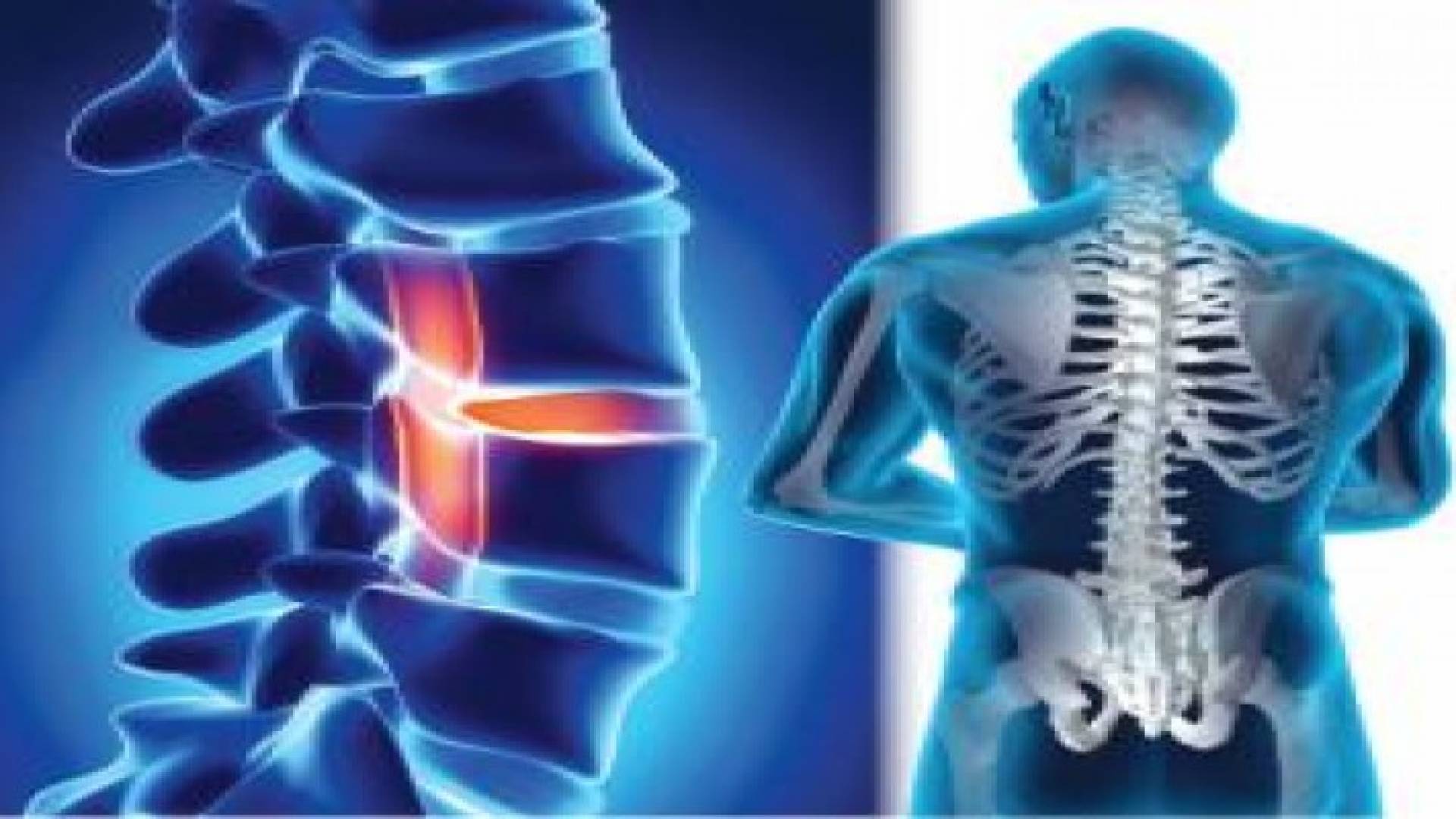 إنجاز طبي أردني في جراحة العمود الفقري