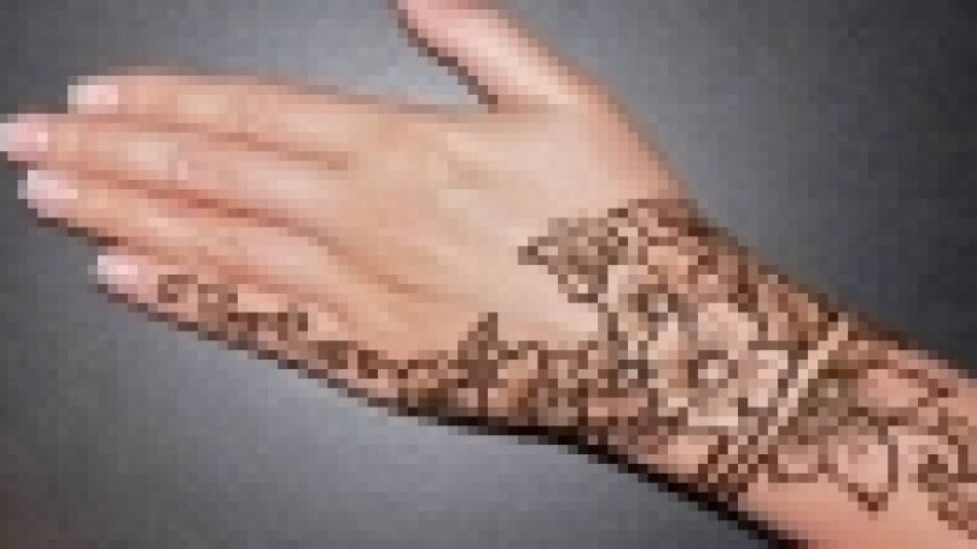 صبغات الشعر والحنة تسبب الحساسية والإكزيما
