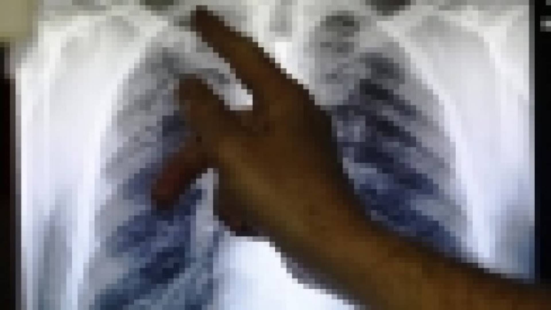 هل يسبب نقص الحديد أمراضا رئوية مزمنة؟