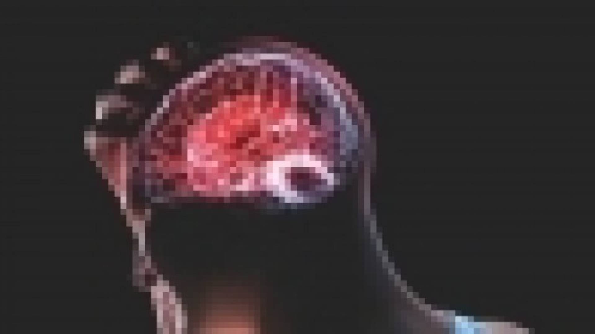 تجربة تبعث أملا لعلاج ورم المخ
