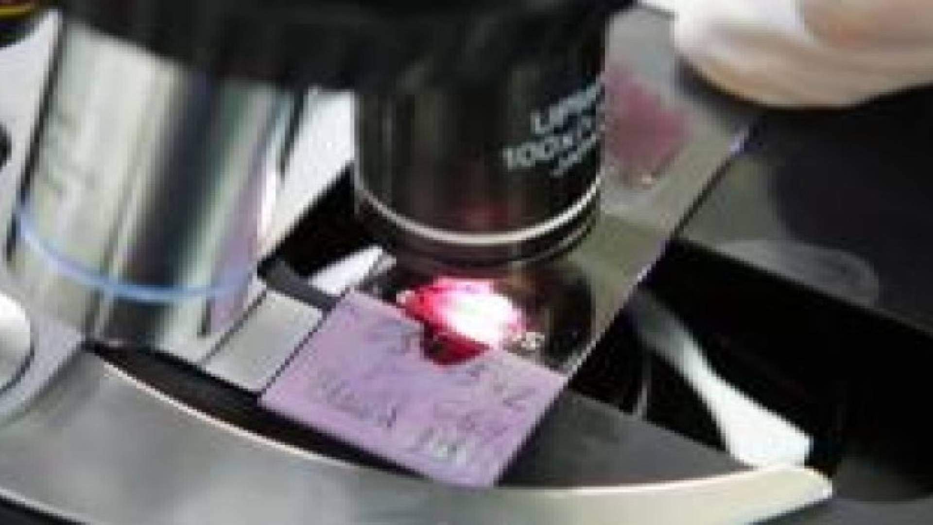 تشخيص "الفصام" عبر عينة من الدم