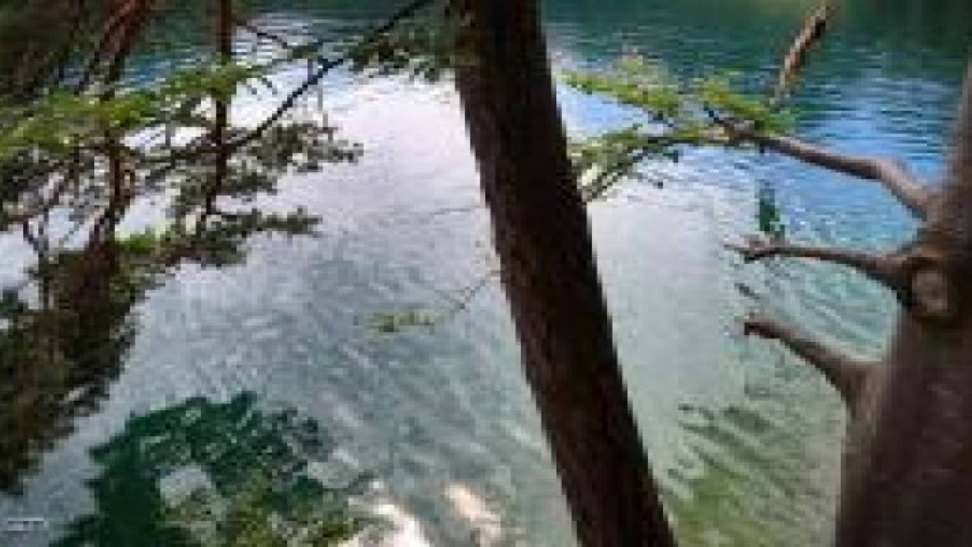 سباحة.. فمرض نادر.. فوفاة