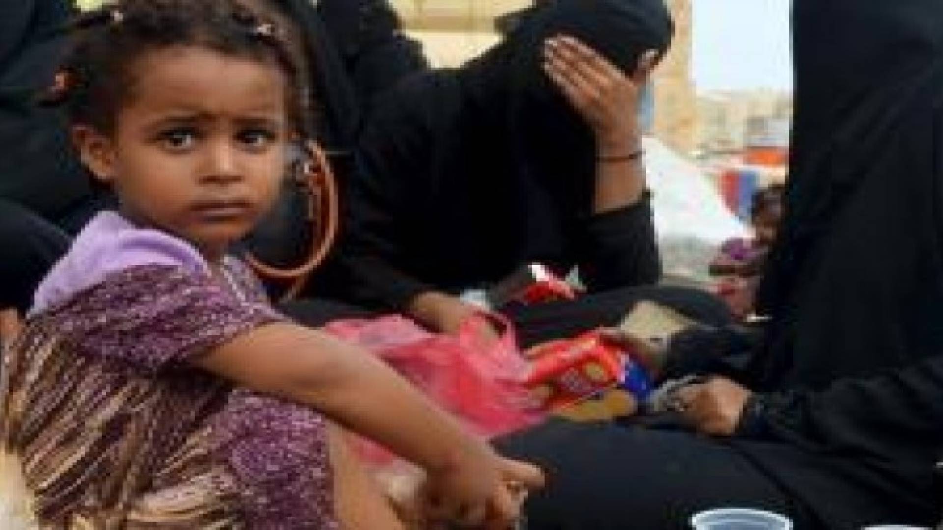 أزمة "غذائية" وشيكة تهدد اليمن والأوبئة بدأت تتفشى