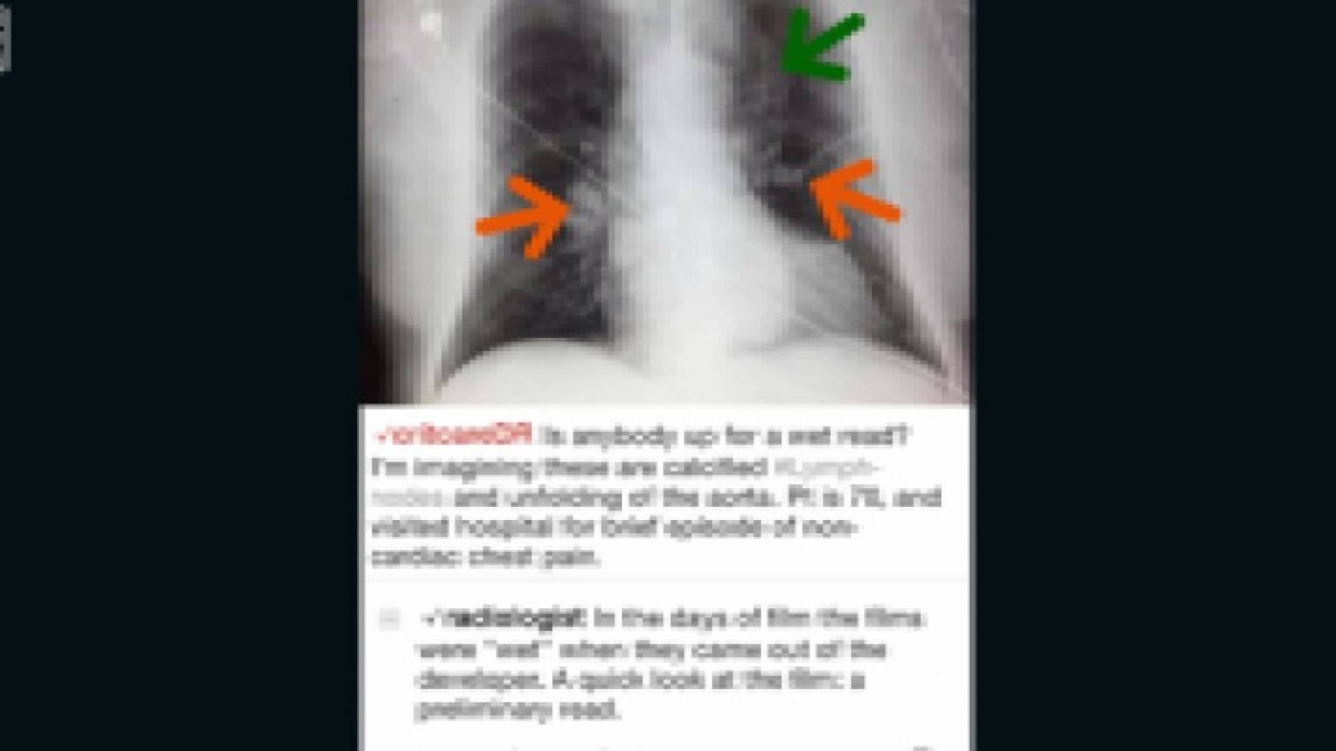 انستغرام طبي.. تطبيق يتيح للأطباء حل قضايا المرضى الغامضة
