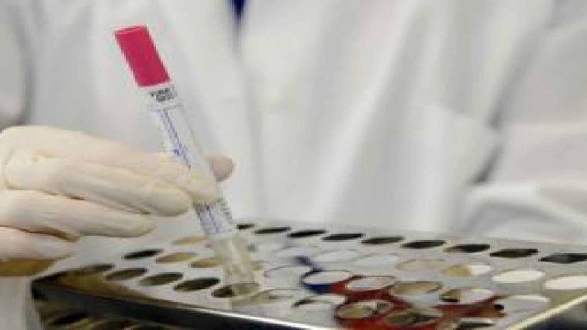 تسجيل اصابة ثانية بالكورونا في الاردن