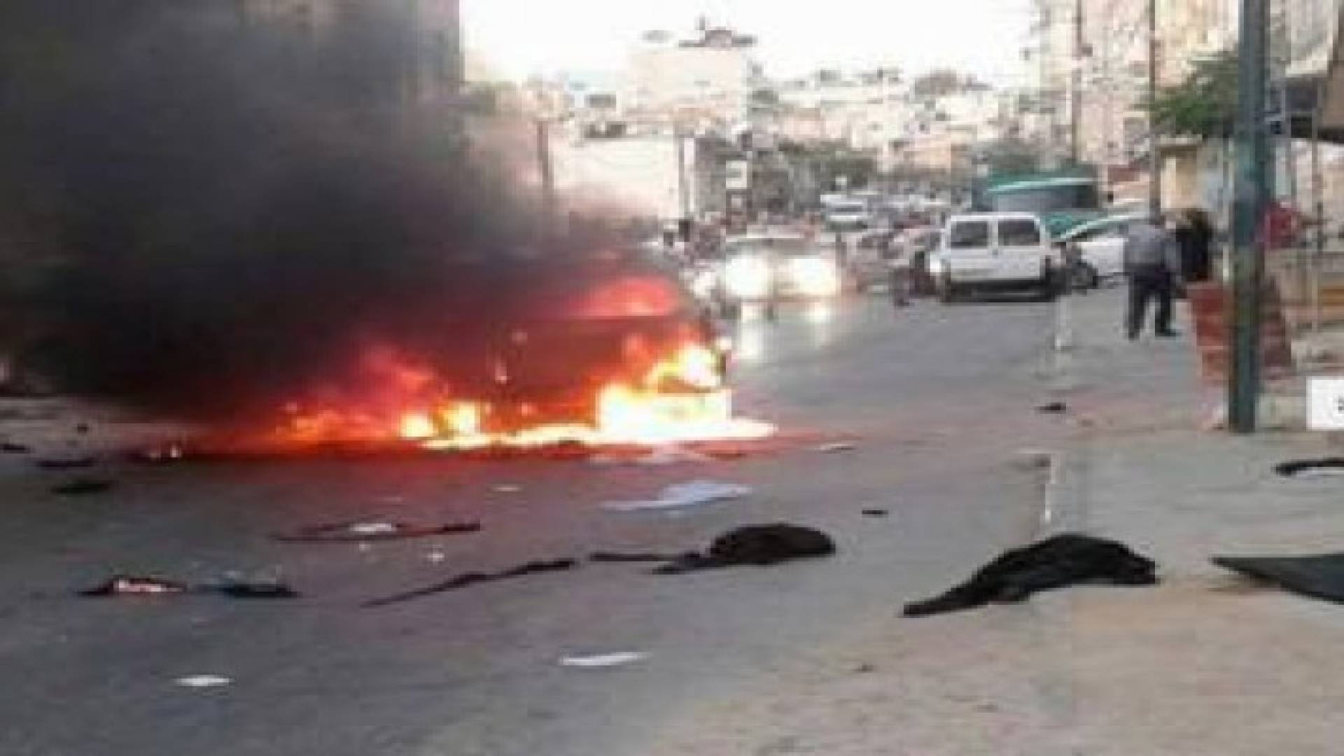 إصابة 5 يهود أمريكان بجروح بهجوم بحارقة بالخليل.. صور