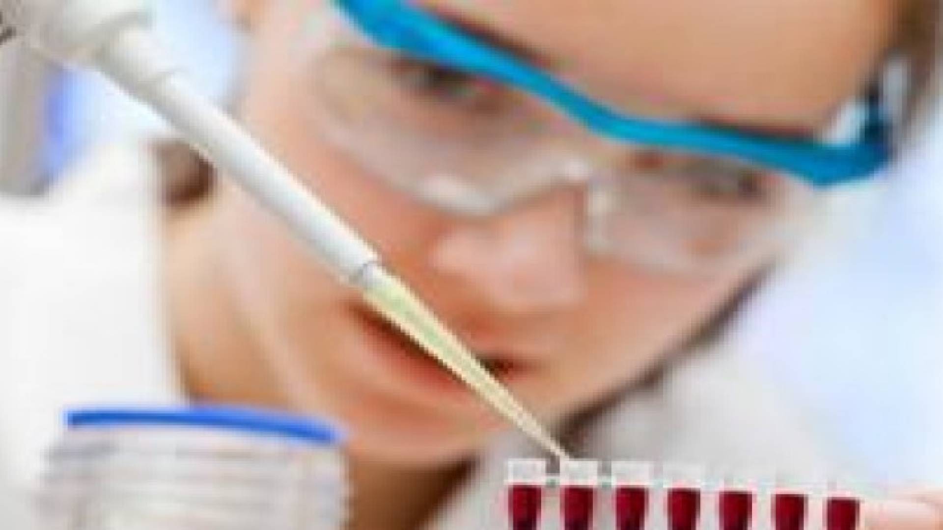 تحليل الدم يمكن أن يشير الى احتمال عودة سرطان الثدي