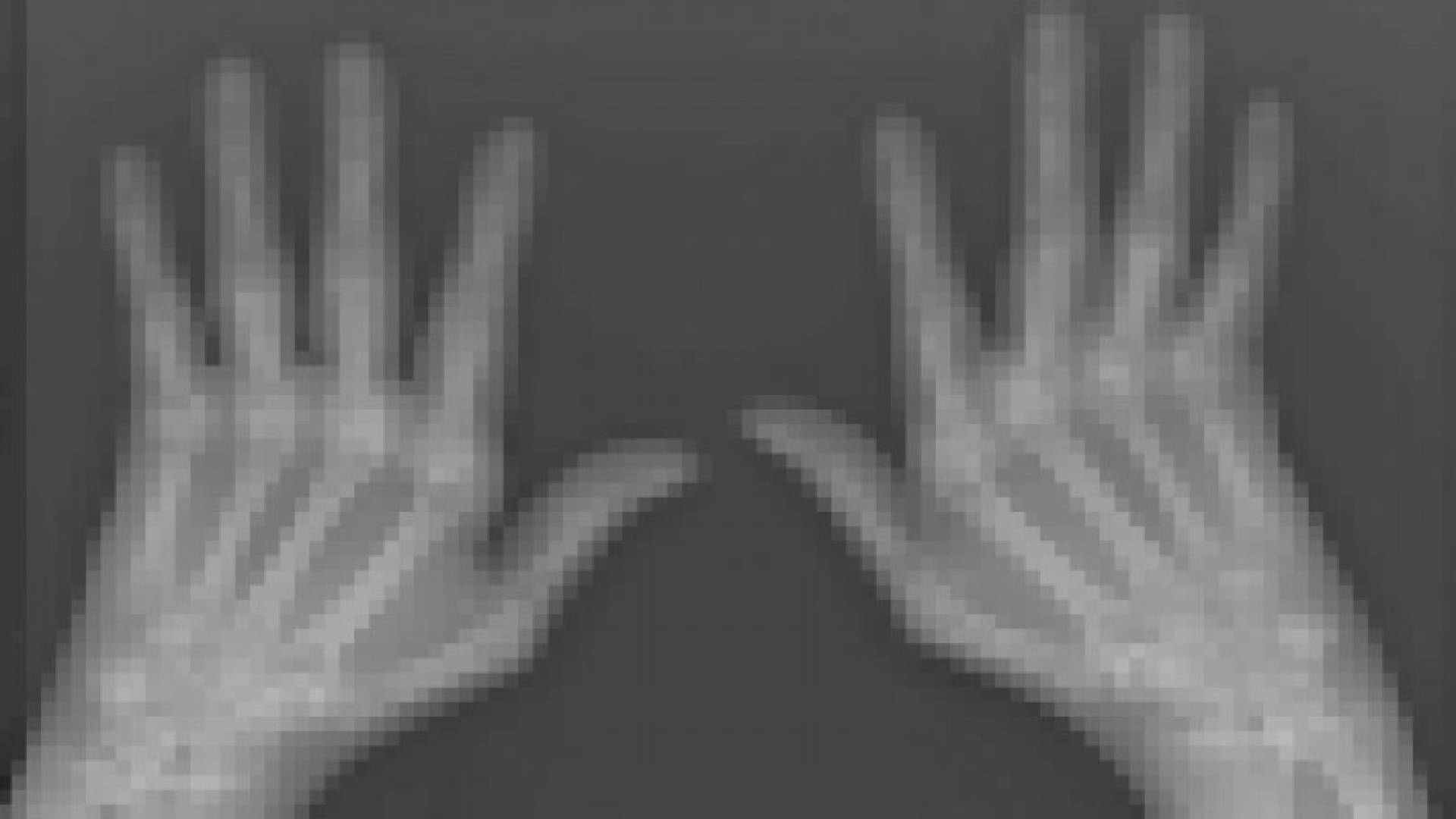 الأغنياء أكثر انزعاجا من التهاب المفاصل