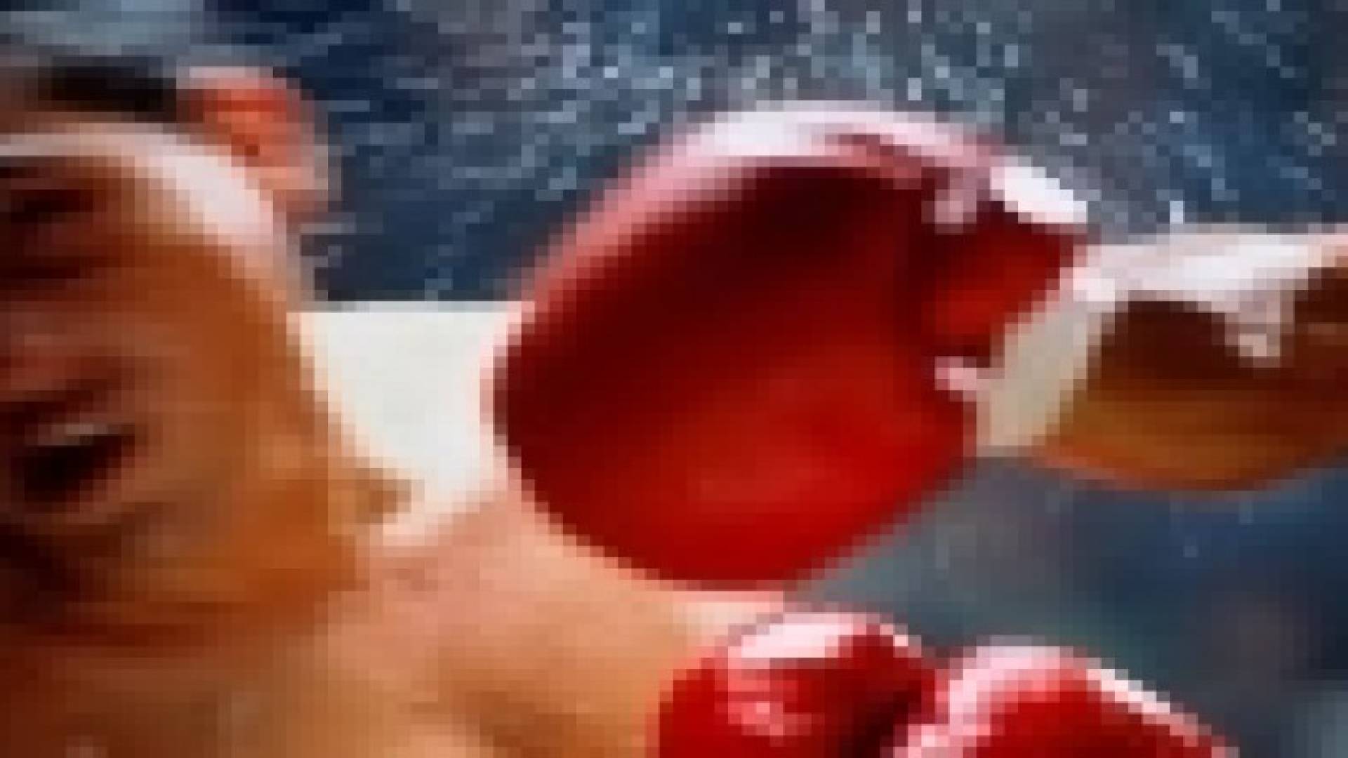 السقوط أثناء الرياضة قد يؤدي إلى ارتجاج المخ
