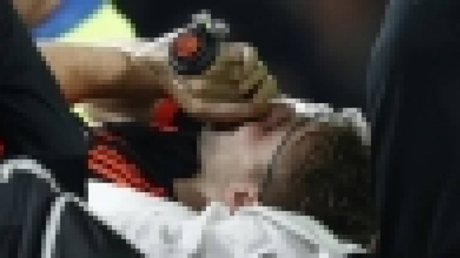 لوك شو يخضع لعملية جراحية ثانية